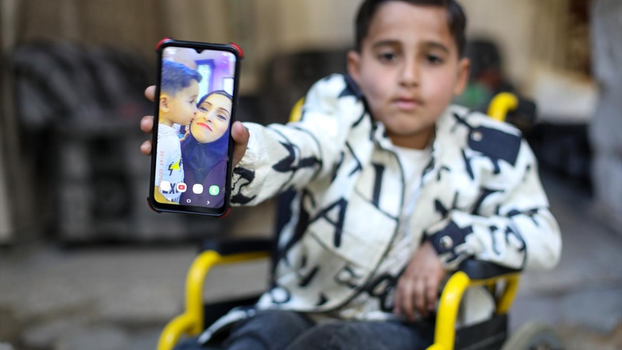 Tedavi umudu yüksek