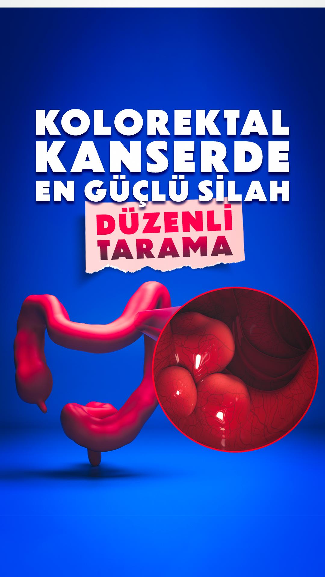 Kolorektal kanserde en güçlü silah: Düzenli tarama