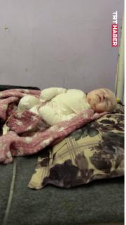 Gazze'de ne tedavi ne de ağrı kesici var