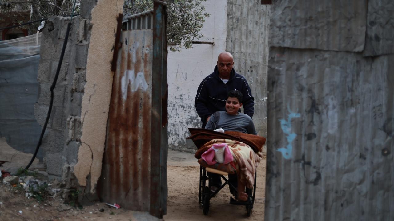 Hem annesini hem elini kaybetti