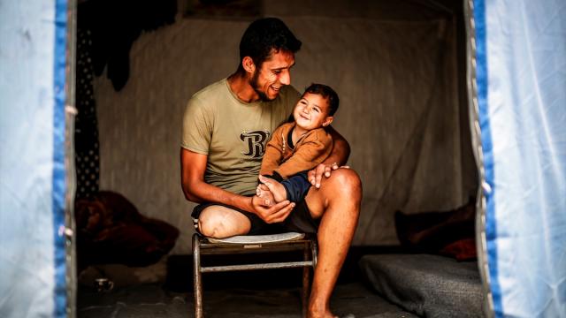 Gazzeli Hamid, ampute edilen bacağıyla hayata tutunmaya çalışıyor
