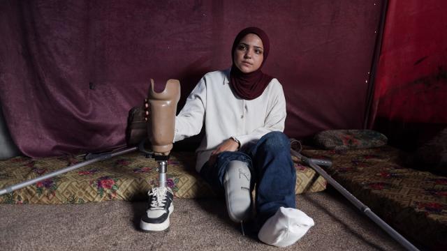 Soykırımcı İsrail'in saldırısında bacağını kaybeden Filistinli kız yaşama tutunmaya çalışıyor