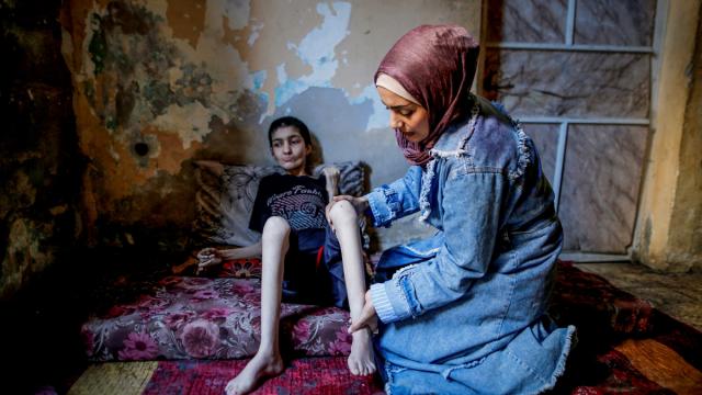 Zihinsel engeli bulunan Filistinli Merve, yetersiz beslenme sorunuyla mücadele ediyor