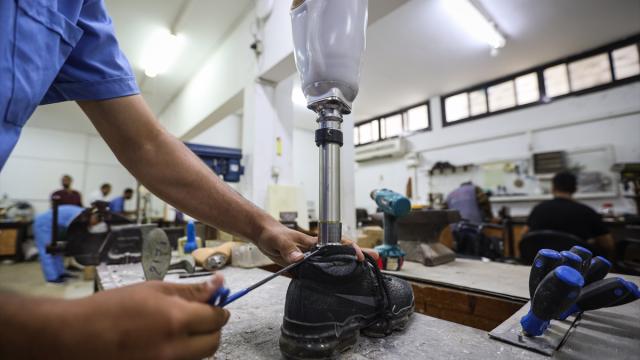 İsrail saldırılarında uzuvlarını kaybeden Gazzeliler proteze ulaşmakta zorluk yaşıyor