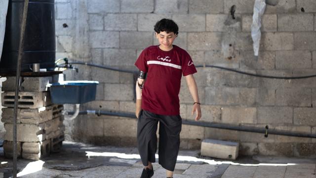 İsrail saldırısında bir kolunu ve bacağını kaybeden Semir Zakkut, protezlerle hayata tutunuyor