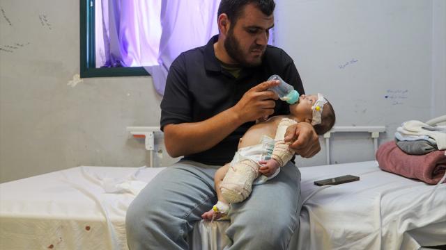 Gazze’de annesini emerken vurulan 50 günlük Muhammed bebek, annesi ve bacağından sonra elini de kaybedebilir