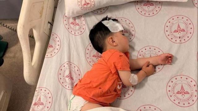 Şanlıurfa'daki köpek saldırısı olayına Mülkiye Müfettişi görevlendirildi