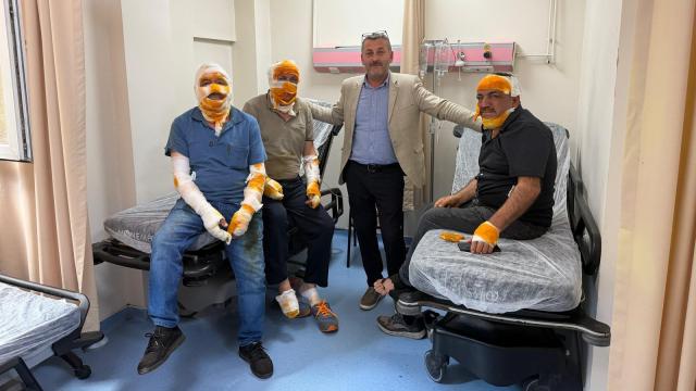 Ordu'da bir evin mutfağındaki patlamada 5 kişi yaralandı haber görseli