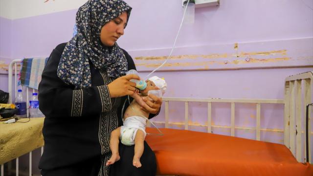 Kalbi delik Filistinli bebek yetersiz beslenme nedeniyle hayatta kalma mücadelesi veriyor