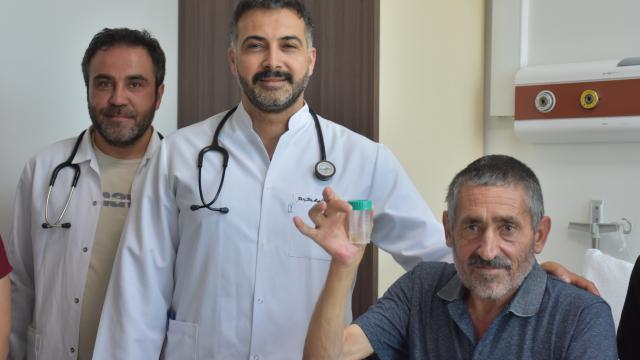 Nefes darlığı yaşayan hastanın akciğerinden sarımsak çıktı haber görseli