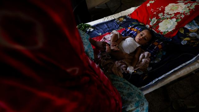 Bangladeş’te Kızamık salgını 20 yılın en ağır seviyesine ulaştı