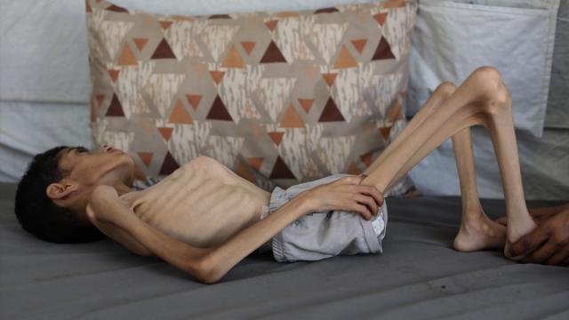 Gazze'de 16 yaşındaki İbrahim'in yaşam mücadelesi