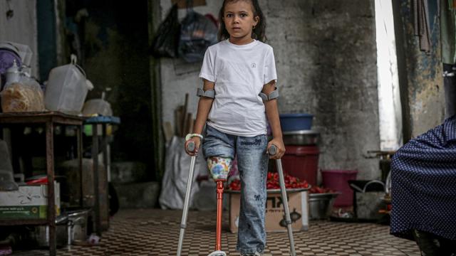 İsrail saldırısında ailesini ve bir bacağını kaybeden Filistinli kız çocuğu yaşama tutunmaya çalışıyor