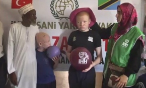 Afrika'nın talihsiz 'albinoları'