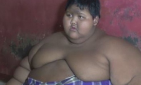 Endonezya'da 192 kilogram çocuk tedaviye alındı