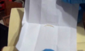 Özel muhafaza içinde tırnak ve kıl parçaları bulundu