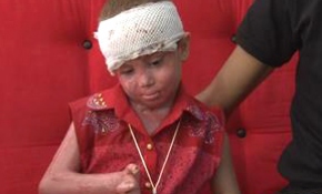 Patlayan trafo minik Elanur'un hayatını kabusa çevirdi