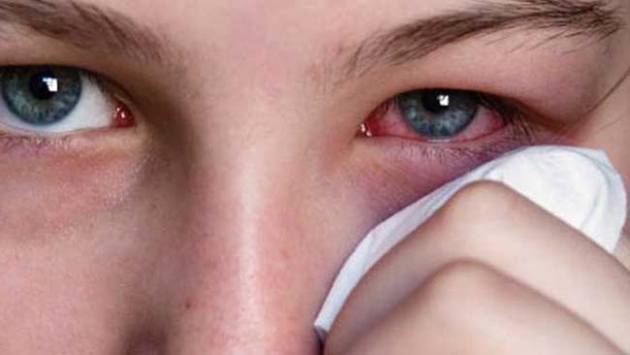 Sonbaharda "gözlere" dikkat