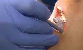 Yapay diş kökü tedavisi ne zaman yapılmalı?