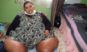 280 kiloya ulaşan genç kız yardım bekliyor