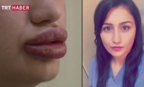 Daha güzel olmak istemişti, sonucu böyle oldu