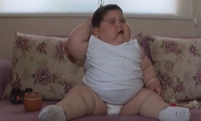 'Leptin hormonu' eksikliği