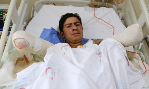 Kuşu kurtardı ama kendi ellerini kurtaramadı