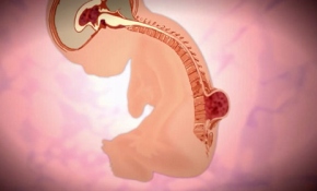 Doğmamış bebeğe mucize ameliyat