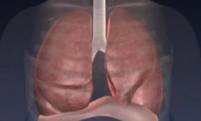 KOAH hastalarına nefes aldıracak yöntem