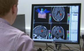 Epilepsi tarih mi oluyor?