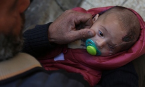 Kerim bebek diğer gözünü de kaybedebilir