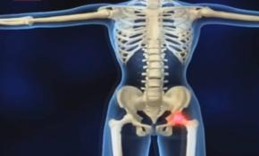 D vitamini bağışıklığı güçlendiriyor, kanserden de koruyor