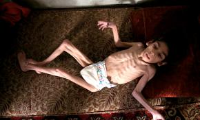 Doğu Gutalı 8 yaşındaki Ravan'ın yaşam mücadelesi