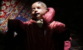 Doğu Guta'nın direniş sembolü Kerim bebek Türkiye'de