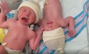 İkiz kardeşinden ayrılınca ağladı, yaklaştırınca sustu