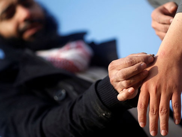 Mısır'ın başkentinde arılarla tedavi