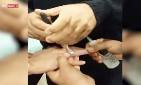 Parmağa sıkışan yüzüğü itfaiye ekipleri çıkardı