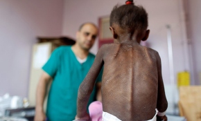 Birleşmiş Milletler Yemen için "kaygılanmaya" devam ediyor