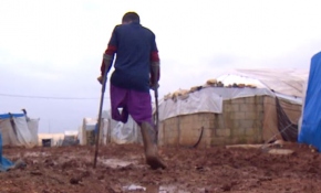 Suriyeli Muhammed protez bacağını kirlenmesin diye kullanmıyor